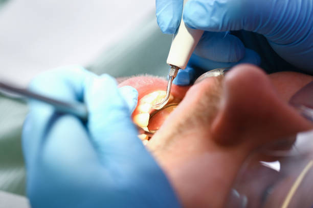Best Urgent Tooth Repair  in Metairie, LA
